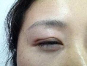 廣州隆鼻手術(shù)：挑選最好的醫(yī)生，口碑盤點！是否有你最滿意的專家？