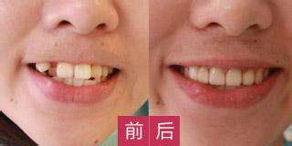 哪家醫(yī)院適合進行磨骨手術？江城和美立方廣受網(wǎng)友推崇！