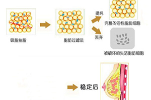 哪位醫(yī)生在八大處做雙眼皮效果最好？最受歡迎的五個(gè)口碑推薦！勢頭強(qiáng)勁！