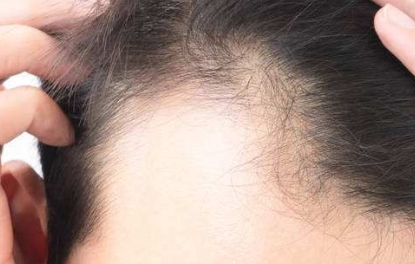 國內(nèi)頂級面部脂肪填充醫(yī)院盤點：頂尖專業(yè)團(tuán)隊，選擇一定不后悔！