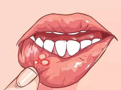 廣州五家專業(yè)眼袋醫(yī)院匯總，重磅推薦中家醫(yī)、華美等！