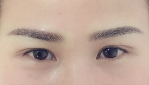 揭秘玉溪整形醫(yī)院匯總：華藝、吳氏嘉美等排行前六，此刻揭開！