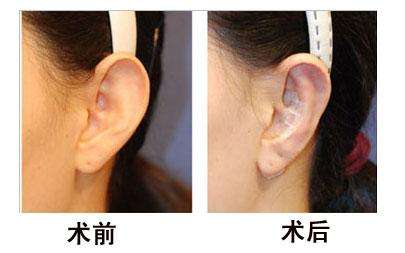 杭州首家頂級(jí)玻尿酸修復(fù)醫(yī)院:珠兒美容醫(yī)院實(shí)力獲得廣泛認(rèn)可 杭州首家頂級(jí)玻尿酸修復(fù)醫(yī)院:珠兒美容醫(yī)院實(shí)力獲得廣泛認(rèn)可