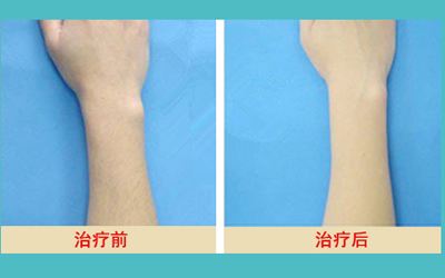 最新發(fā)布！匯總?cè)箩t(yī)院名單，解決牙齒問(wèn)題待了整整一年