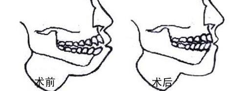 提供重慶哪家私立醫(yī)院割雙眼皮好？前五推薦_軍美領(lǐng)先，再揭秘