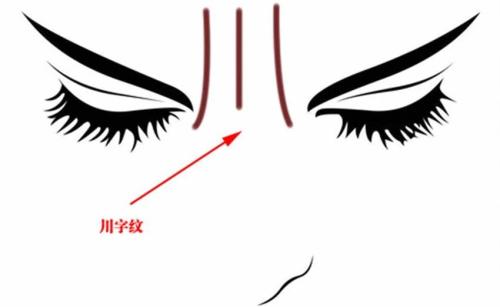 成都雙眼皮修復(fù)手術(shù)：五家性價(jià)比高、技術(shù)好的醫(yī)院推薦