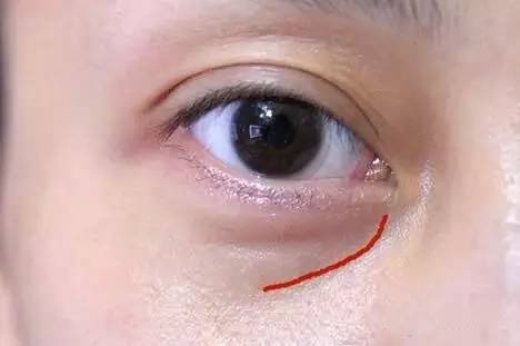 沈陽哪家醫(yī)院做雙眼皮好？推薦這幾家，讓你的雙眼美麗動人起來！