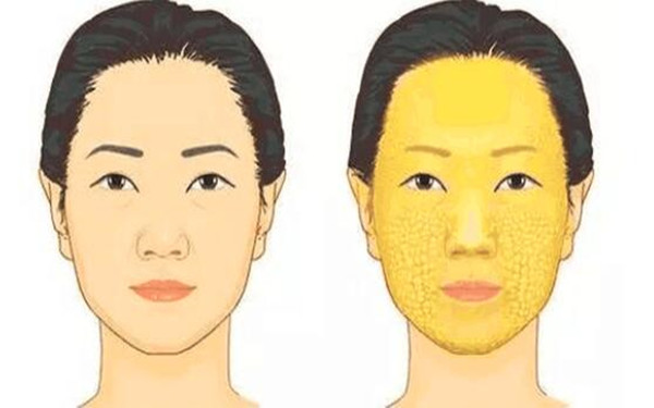 滄州治療疤痕的正規(guī)醫(yī)院推薦：專業(yè)科技祛疤，效果顯著！點擊了解！