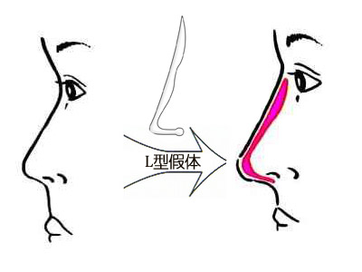 深圳最佳激光脫毛整形醫(yī)院推薦-公立醫(yī)院領(lǐng)跑市場！