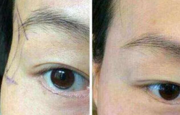 江蘇區(qū)整容醫(yī)院推薦：想在江蘇改頭換面的友人來(lái)看看這篇！高質(zhì)量美容機(jī)構(gòu)盤點(diǎn)提供參考