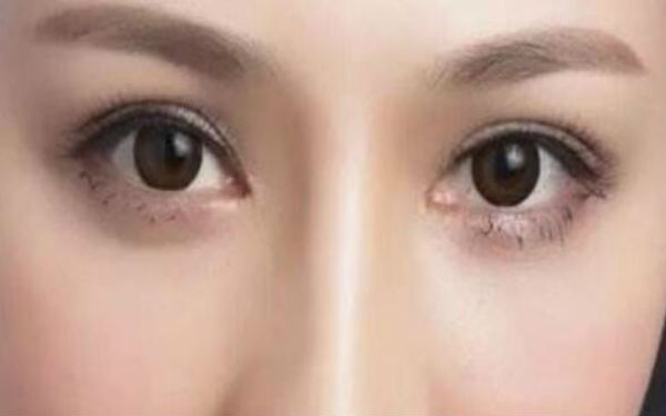 邯鄲割雙眼皮醫(yī)院排行榜TOP5——萊媚儷與德枝美，你需要看看