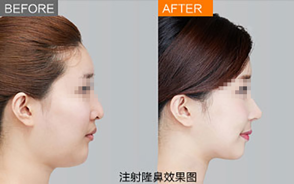 鄭州唇部整形醫(yī)院推薦：如何選擇合適的醫(yī)院？友友必看！