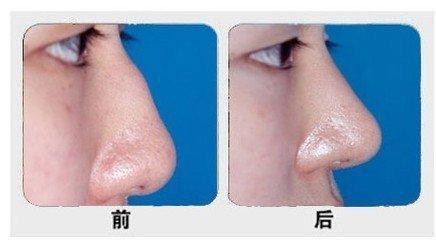 石家莊主要公立整形醫(yī)院排行榜！公辦醫(yī)療機(jī)構(gòu)最具實力！