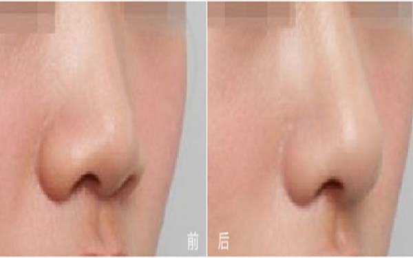 福建五所知名整形醫(yī)院盛世薈萃：瑞麗、愛思特、雅美等品牌強勢入圍！