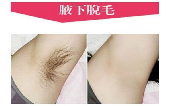 聚焦常州激光醫(yī)院效果盤點：美麗年輕無止境！