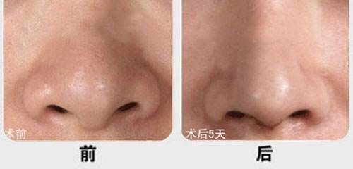廈門市有哪些醫(yī)院提供優(yōu)質(zhì)的脂肪填充服務(wù)？江頭醫(yī)院、臉康整形醫(yī)院、美麗醫(yī)療中心等值得一看！快來了解一下
