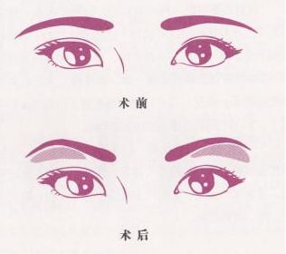 魅力煥發(fā)！常德市多家信譽(yù)醫(yī)院助你邁過(guò)疤痕困擾