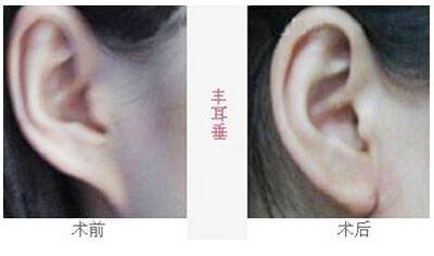 2023沈陽去魚尾紋雕塑醫(yī)院排行榜，這十家都備受口碑推崇！