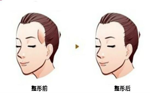 西寧顴骨矯正術：哪家醫(yī)院口碑好？2023年口碑排名前10的正規(guī)醫(yī)療整形醫(yī)院公布！