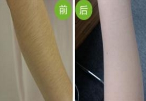 哪家南京雙眼皮手術(shù)醫(yī)院口碑好？2023年南京韓式雙眼皮手術(shù)前十名排序！