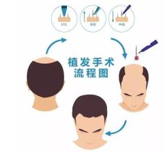 臺州哪里可以去除下眼皮皺紋？2023臺州排名前十的美容醫(yī)院推薦