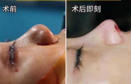 南京最熱門的環(huán)形精雕吸脂醫(yī)療美容醫(yī)院綜合推薦！2023年排行前十名大揭曉！