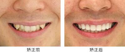 高性價(jià)比的滁州曼托水滴型假體隆胸整形醫(yī)院推薦！2023年滁州曼托水滴型假體隆胸醫(yī)院TOP10口碑排行，實(shí)力醫(yī)