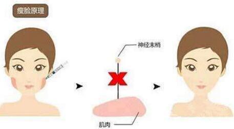 【2023】徐州眉間紋物理祛除醫(yī)院推薦，口碑好的整形醫(yī)院排行！