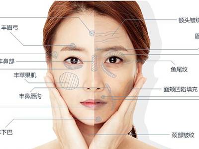廣州臉部打溶脂針排名前10的美容醫(yī)院口碑大揭秘！2023年很受好評(píng)的整形醫(yī)院技術(shù)盤(pán)點(diǎn)！
