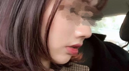 貴陽有哪些專業(yè)的磨皮去痘印醫(yī)院？2023年TOP10推薦實力醫(yī)院揭曉