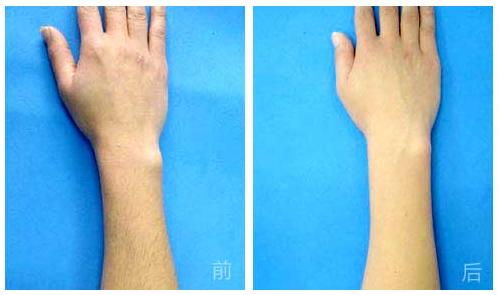 杭州哪家整形美容醫(yī)院能有效避免眼部皺紋？2023年杭州眼部皺紋美容醫(yī)院前十位排行榜來啦！