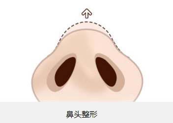 2023廈門注射豐耳垂術(shù)美容醫(yī)院前10強(qiáng)榜盤點(diǎn)，哪家口碑比較好？
