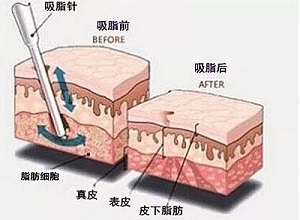 2023蕪湖鼻梁骨矯正醫(yī)院久負(fù)盛名，口碑贊譽(yù)不絕于耳！
