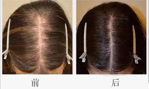 廣州哪些醫(yī)院可靠，專業(yè)進(jìn)行臉部疤痕切除整形美容？2023年十大排名公開！