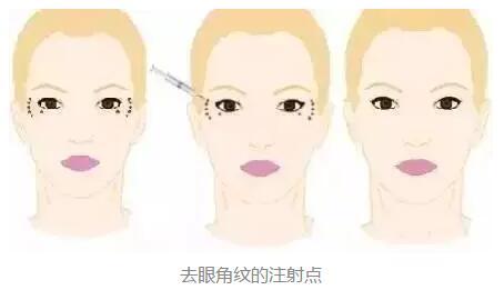 2023年北京鼻端缺損整形美容醫(yī)院前十強排名揭曉！知名度爆棚的醫(yī)療機構(gòu)盤點！