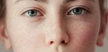 上海眼部自體脂肪移植醫(yī)生實(shí)力排名及案例效果解析