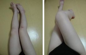 上海漏斗胸矯正手術(shù)排行前十整形醫(yī)院名單揭曉：權(quán)威專業(yè)領(lǐng)航行業(yè)之巔！
