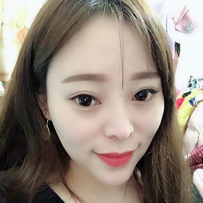 術(shù)前矮低平，術(shù)后高挺翹~肋軟骨隆鼻效果好的不得了！