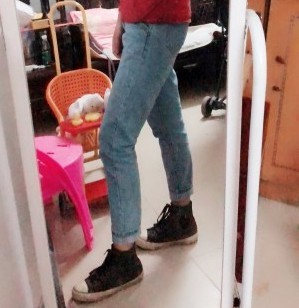 胖腿女孩兒福利分享：吸脂瘦大腿的蛻變，效果值得點(diǎn)贊！