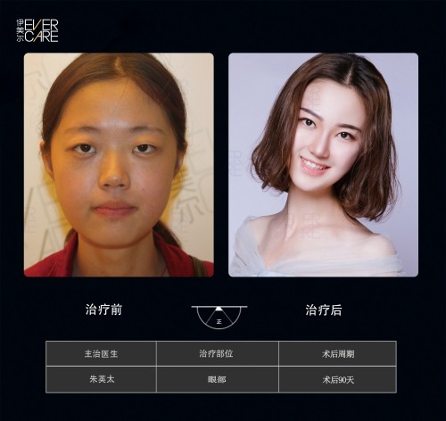阿爾法9°美眼，打開視界，美無止境