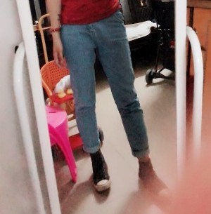 胖腿女孩兒福利分享：吸脂瘦大腿的蛻變，效果值得點(diǎn)贊！