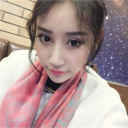 雙眼皮失敗丑的不敢見(jiàn)人，昆明麗都整形雙眼皮修復(fù)案例分享