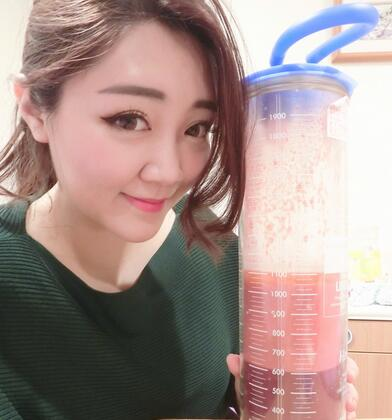 揭陽(yáng)美萊整形手臂吸脂案例分享，輕松告別拜拜肉