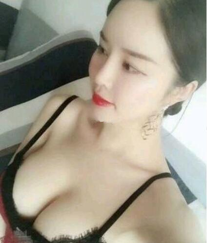 福州海峽假體隆胸案例術(shù)后兩個月