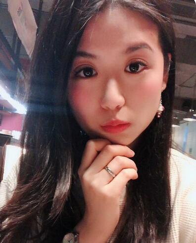 汕頭曙光整形皮秒激光祛斑一個月效果