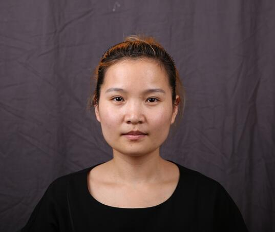 廈門華美名媛整形醫(yī)生賈虹下頜角削骨案例效果對(duì)比圖！