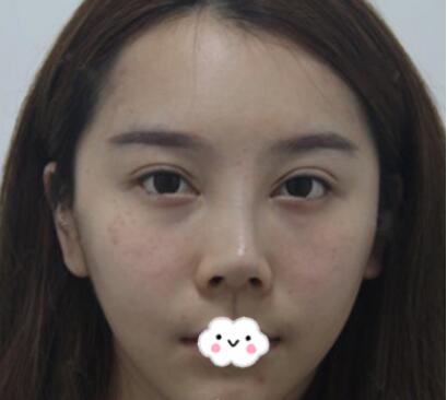 手術前的準備