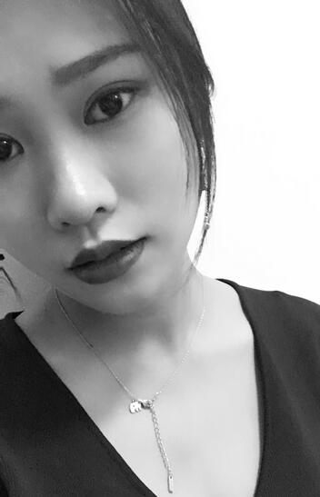 上海伊美爾港華整形醫(yī)生師麗麗做雙眼皮怎么樣？師麗麗雙眼皮案例分享