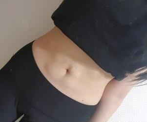 廣州星團醫(yī)學(xué)整形醫(yī)生顧鵬做腹部吸脂效果怎么樣？顧鵬腹部吸脂案例展示