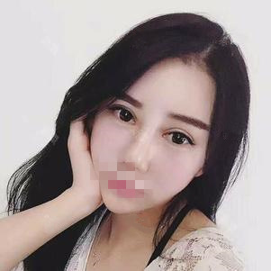 東莞維多利亞做硅膠隆鼻怎么樣？整形醫(yī)生李剛硅膠隆鼻案例分享